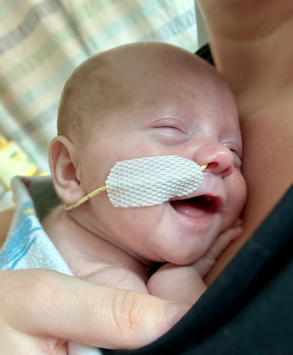 A small baby is cradled against an adult’s chest. She appears to be smiling and has a tiny tube taped to her face going into her nose.